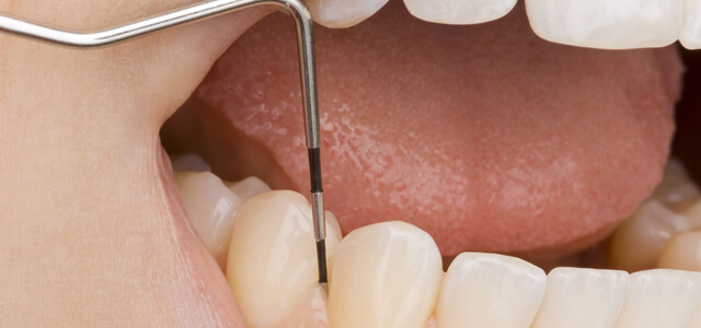 Parodontologie (Parodontitisbehandlung)
